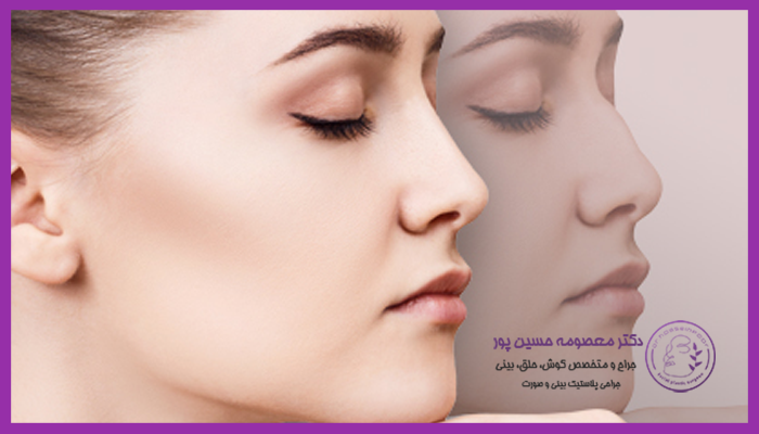 جراحی ترمیمی بینی