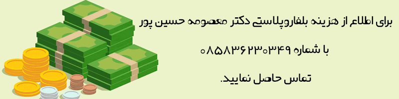 عوامل تاثیرگذار در هزینه عمل بلفاروپلاستی