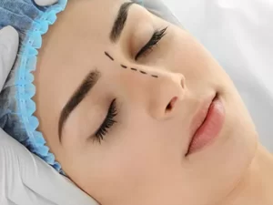 خوابیدن بعد از عمل بینی