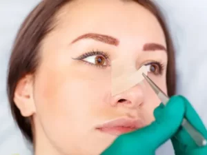 چسب زدن بعد از عمل بینی