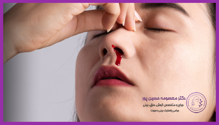 علل خونریزی پس از عمل بینی