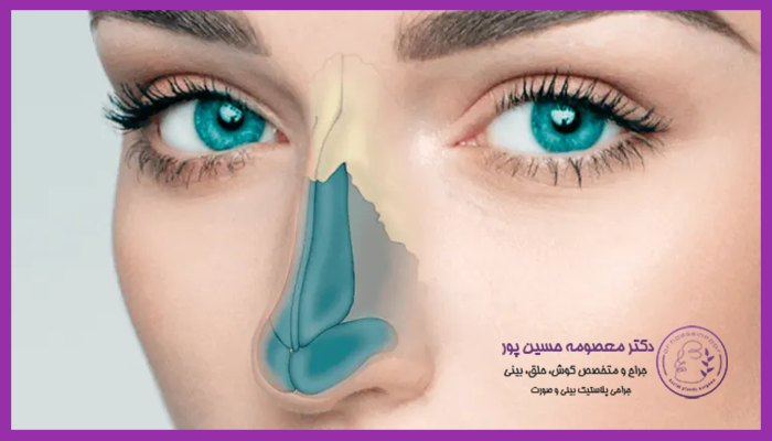 عوامل تاثیر گذار در مدت زمان جراحی بینی