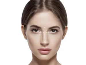 جراحی بینی غضروفی