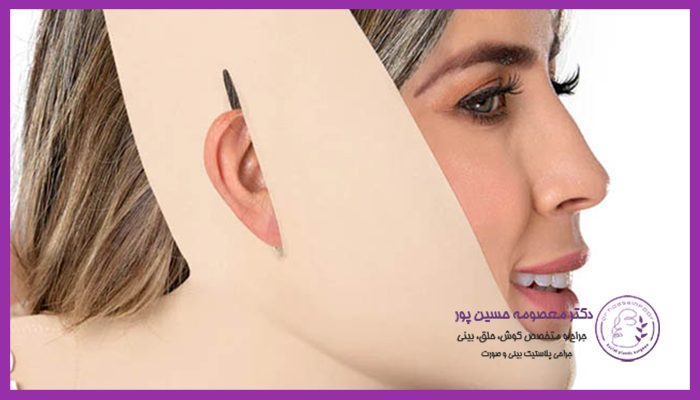 مزایای استفاده از گن بوکال فت
