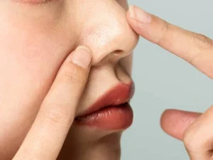 چرب شده پوست بینی بعد از عمل