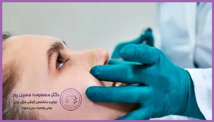 علت ایجاد گوشت اضافه بعد از عمل بینی