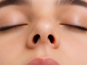 رفع جای بخیه بعد از جراحی بینی با رعایت مراقبتهای لازم